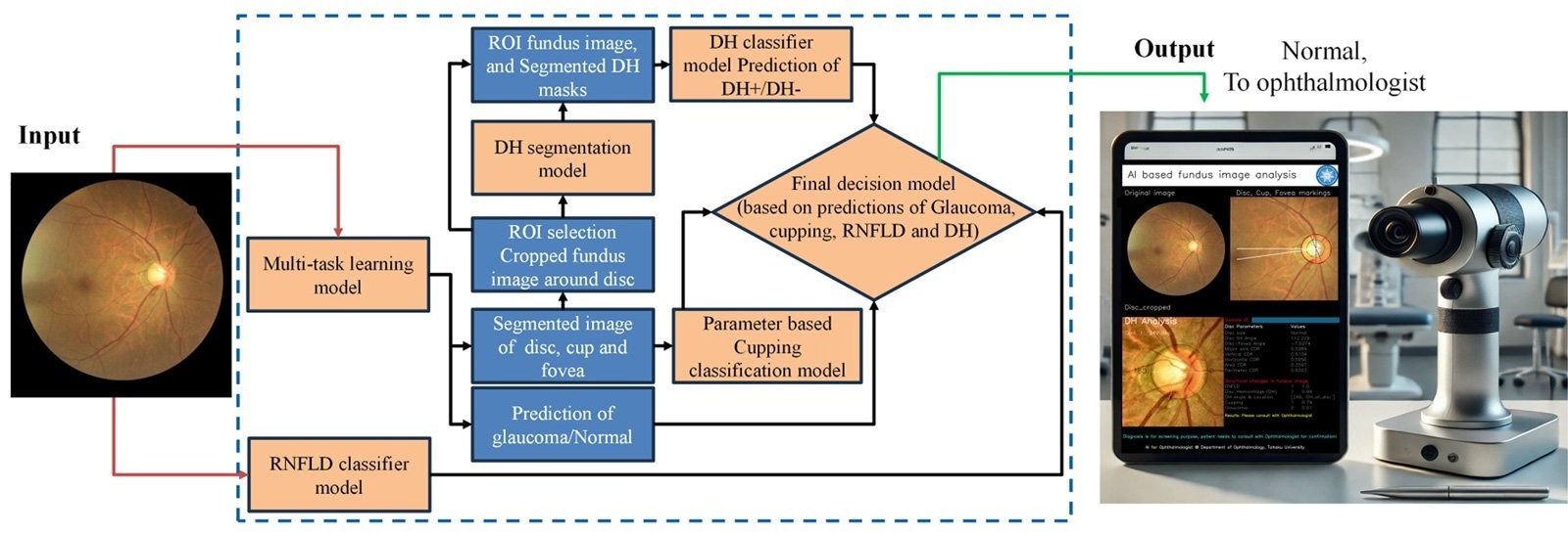 AI-Based Glaucoma Screening