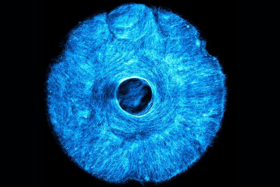 The artificial, muscle powered structure that pulls both concentrically and radially, much like how the iris in the human eye acts to dilate and constrict the pupil.