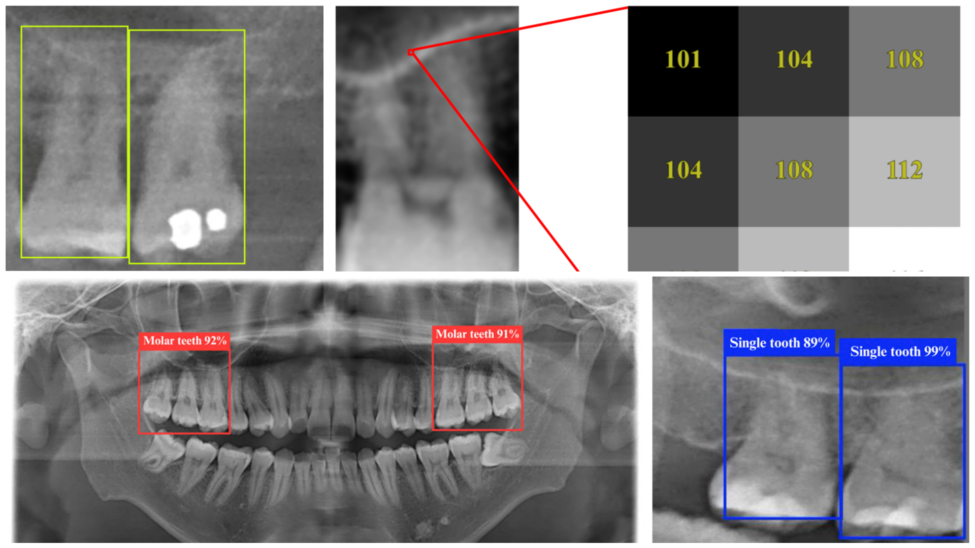 Deep Learning Model for Accurate Detection of Tooth and Sinus Structures in Dental X-rays