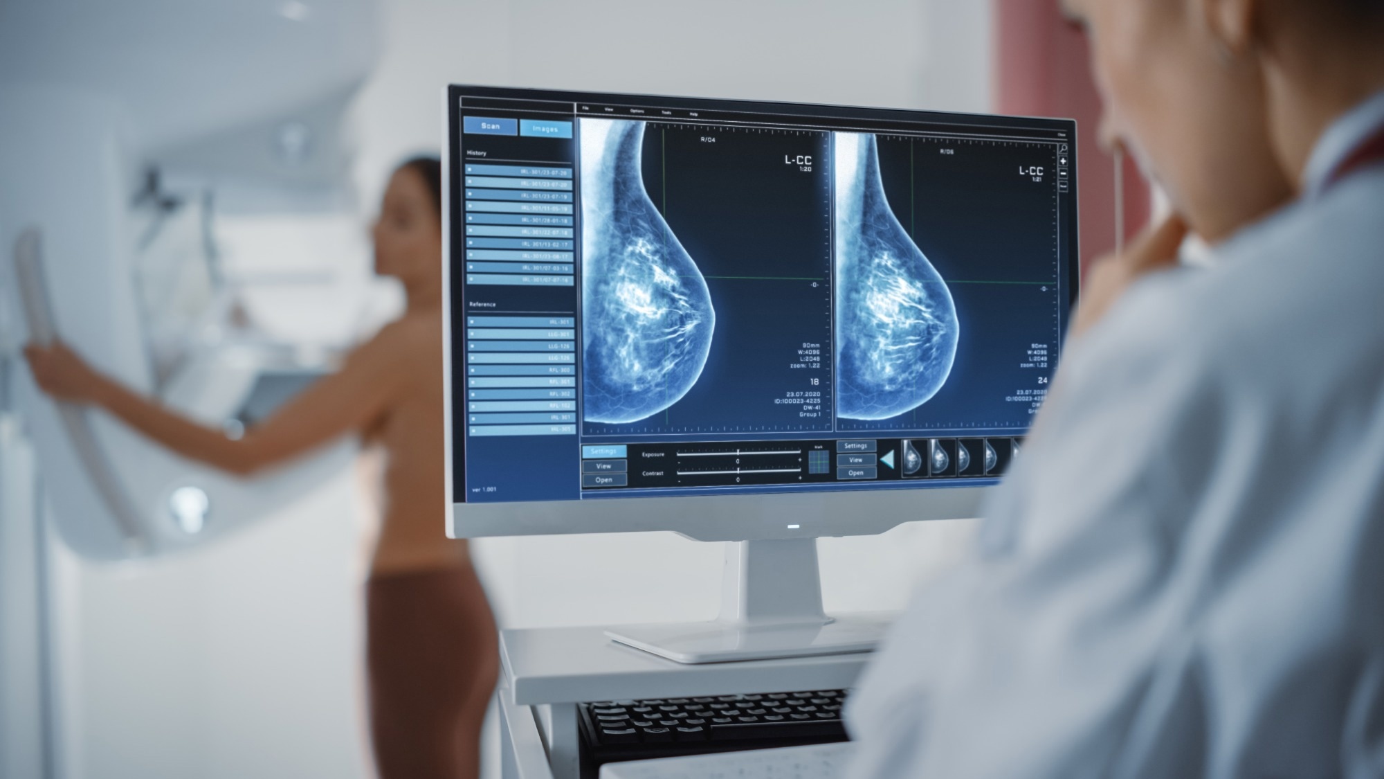 AI Could Enhance Interval Breast Cancer Detection
