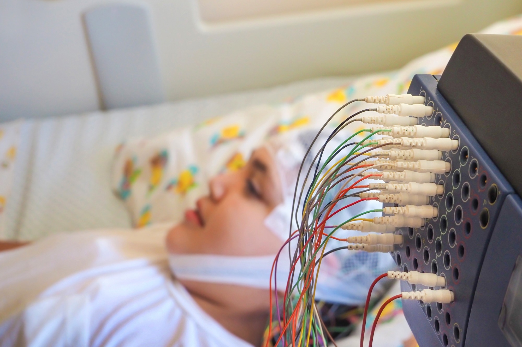Social Media-Trained AI Can Spot Rare Infant Seizure Disorder