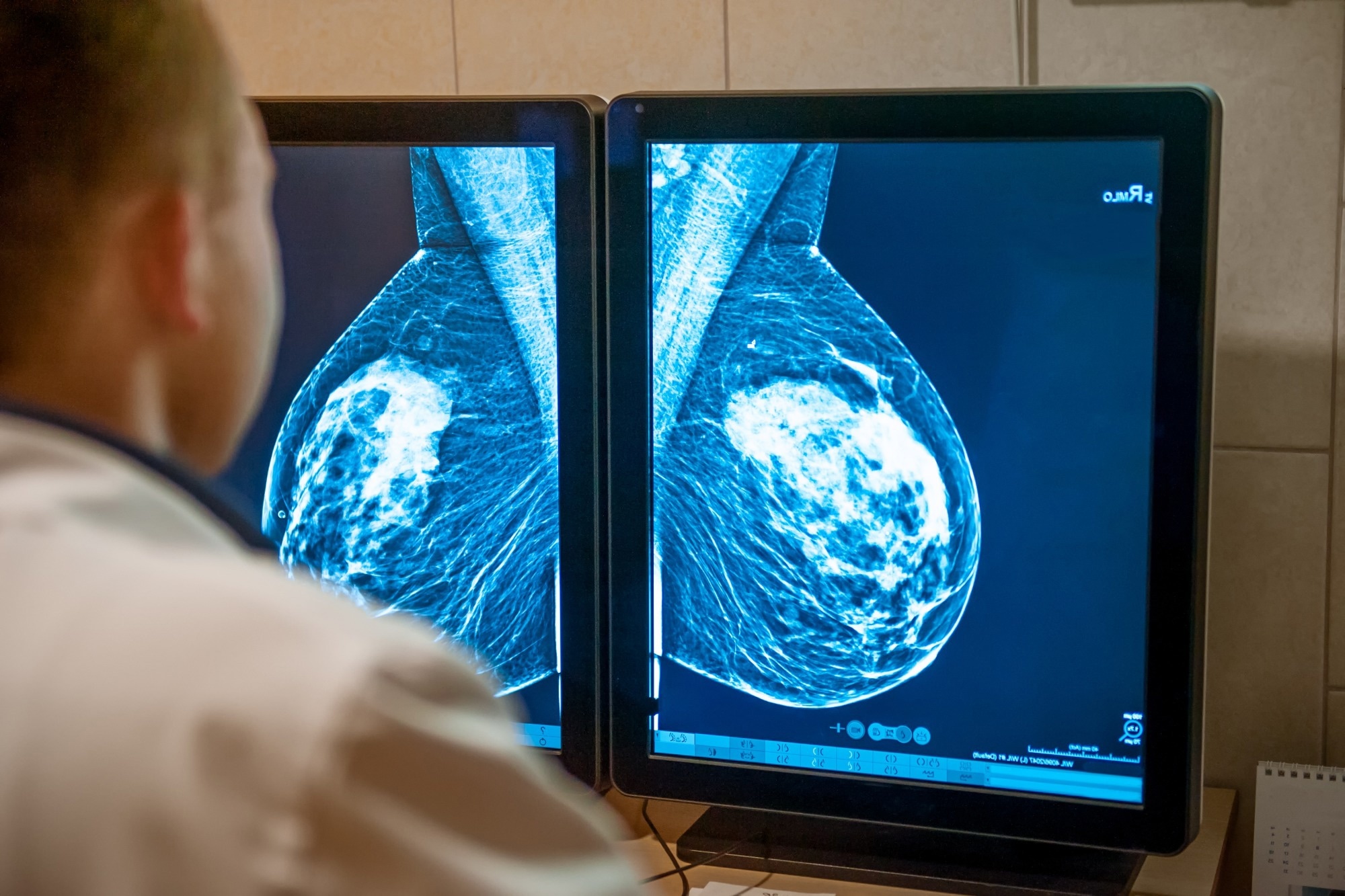 AI-Enhanced Imaging Technique Offers a Safer, More Comfortable Option for Breast Cancer Screening