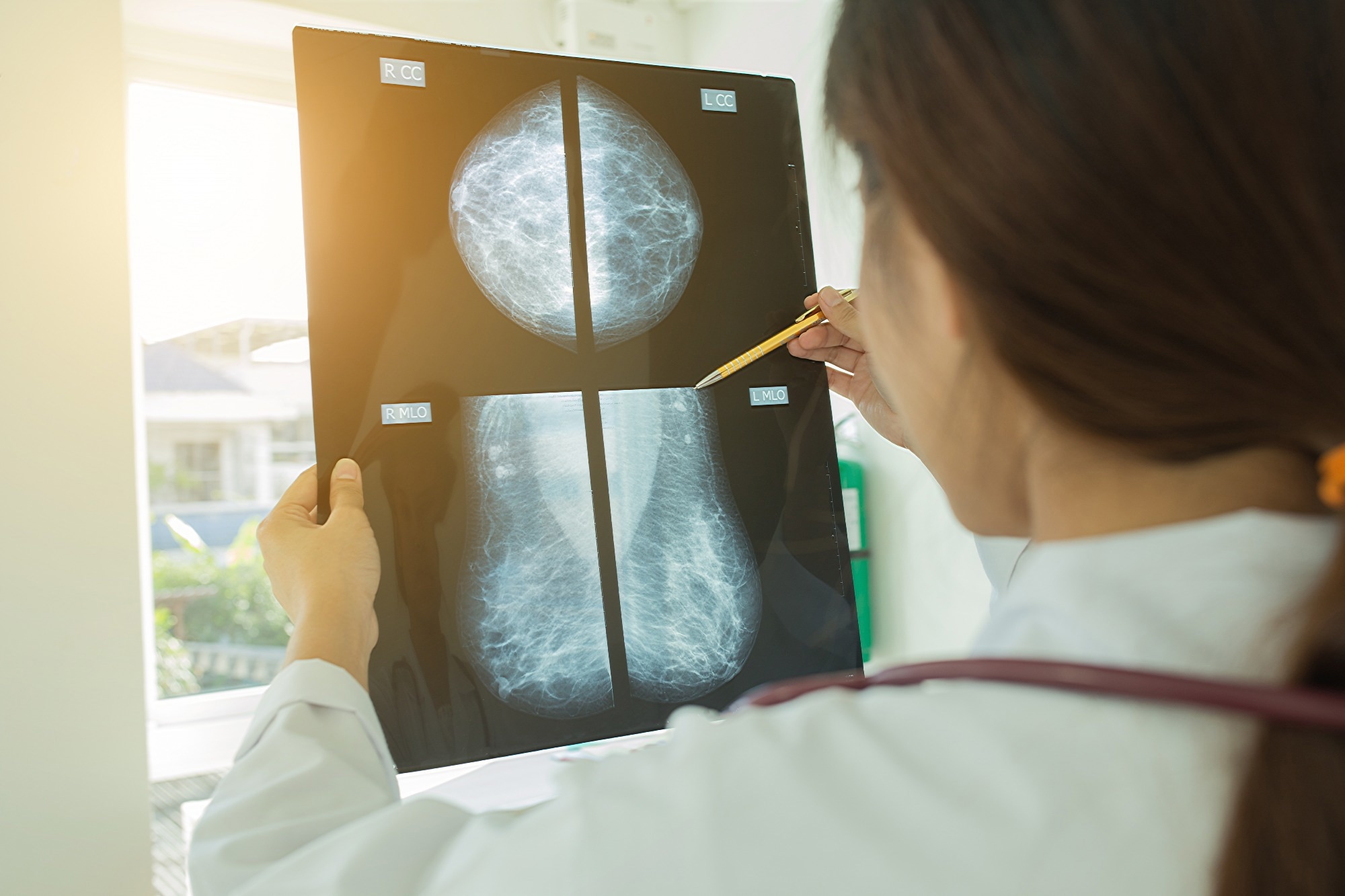 Female doctor looking at a Mammogram film image.