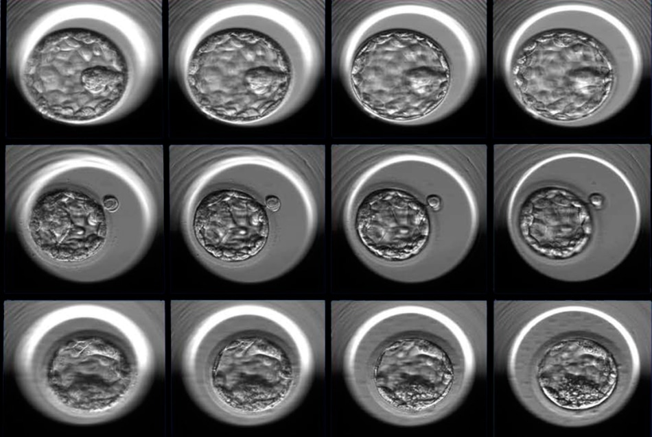 Researchers Develop Artificial Intelligence Approach to Improve Embryo Selection for In Vitro Fertilization