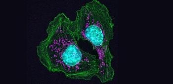 Literature-Based Discovery System Uses AI to Quicken Search for Cancer Discoveries