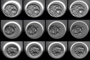 Researchers Develop Artificial Intelligence Approach to Improve Embryo Selection for In Vitro Fertilization