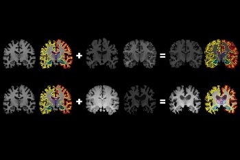Medical Artificial Intelligence for Diagnosing and Treating Brain Conditions