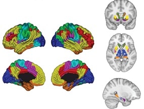 Artificial Intelligence can Help Predict Effects of Antidepressants