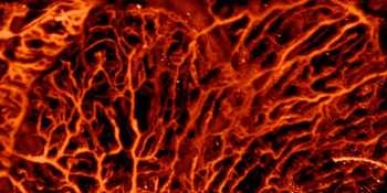 Scientists Use Machine Learning Methods to Improve Optoacoustic Imaging