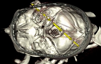 Monash Designs Technology to Map Bullet Trajectory