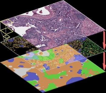 New AI Algorithm Offers Robust Way to Detect Tumor Cells