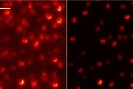 AI-Based Method of Image Analysis Finds New Cell Types in Tissue