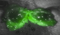 Surgical Team at USMD Hospital Implement Fluorescence Imaging Techniques for Robotic Surgery