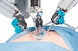 Robotic and Single-Incision Surgery Combined to Remove Gallbladder