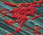 Research Shows UV Robots Reduce Transmission of Common Bacterial Infection Among Cancer Inpatients