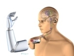 Researchers Create Breakthrough Mind-Controllable Prosthesis Using Electrode System