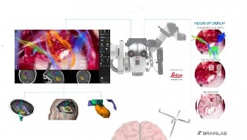 Mount Sinai Neurosurgeon Uses Next-Generation Augmented CaptiView Virtual Reality Tool During Surgery
