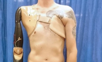 New Robotic Prosthetic Arm Detects Spinal Nerve Signals