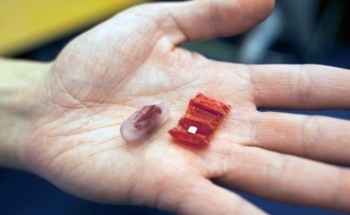Ingestible Origami Robot Has Potential to Remove Swallowed Button Batteries