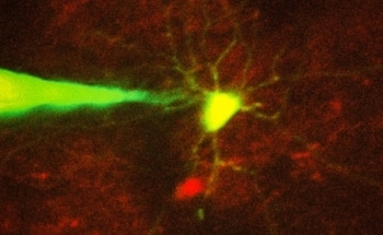 MIT Researchers Create Robotic System to Monitor Specific Neurons in Brain