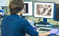 AI Techniques Found to be Highly Unstable in Medical Imaging