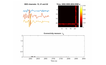 AI Enables a More Efficient Way to Detect Epileptic Seizure in Real Time
