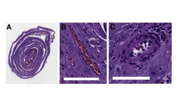 New AI-Based Method can Identify Health Risks in Future Pregnancies