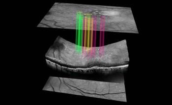 New AI-Based Eye Test may Predict Early Macular Disease