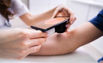 New Google AI Tool Could Potentially Identify Skin Conditions