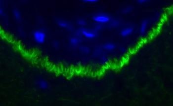 AI System Recognizes a Certain Pattern in Skin Biopsies from Blistering Disease Patients