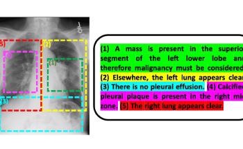 Researchers Improve Interpretive Abilities of AI by Using Radiology Reports