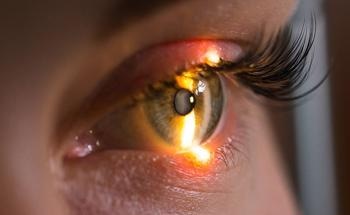 New AI-Based Rapid Screening Test for Glaucoma Could Enable Early Detection