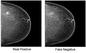 Image-Tampering Attacks can Deceive AI-Cancer-Spotting Models and Human Experts