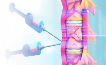Researchers Stabilize ChABC to Degrade Scar Tissue and Promote Tissue Regeneration in SCI Patients