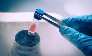 AI-Based Nanofountain Probe Electroporation Platform for Efficient Development of Stem Cells