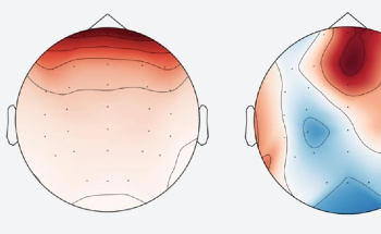 AI Processes Brain Electrical Activity to Diagnose Depression, Mind-control Gadgets, and More