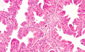 Researchers Create New AI-Based Techniques for Analyzing Digital Pathology Data