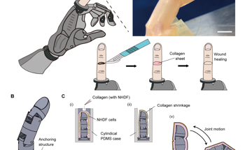 Robotic Finger With Self-Healing Skin