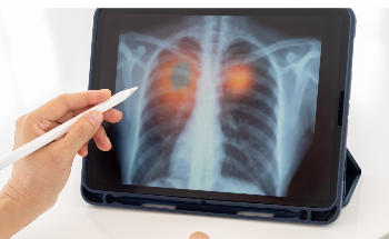 AI Could Be Used in Diagnosis of COVID-19 and Other Medical Complications