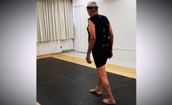 AI Aids in Parkinson’s Diagnosis and Gait Change Detection