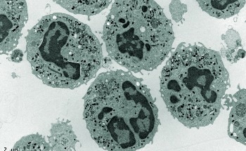 XtalPi Partners with CK Life Sciences to Jointly Develop New AI Tumor Vaccine R&D Platform