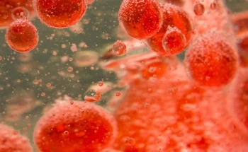 AI Determines the Consequences of Twisting Arteries