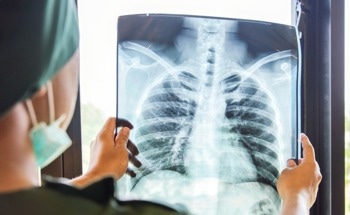 AI Distinguishes Between Normal and Abnormal X-Rays