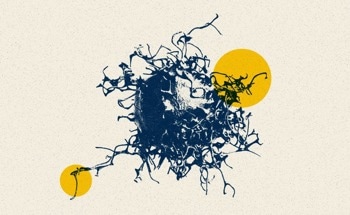 Streamlining the Diagnosis and Treatment of Gliomas Using AI