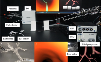 Robotic Bronchoscope for Pulmonary Lesion Navigation and Biopsies
