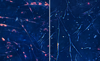 AI Finds Drug Candidates To Target Aging-Associated Cells