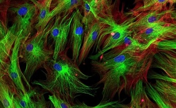 AI Could Help Scientists Understand Differences in Cancer Tumors