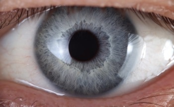 New AI System to Identify the Genetic Cause of IRDs From Retinal Scans