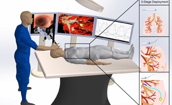 Robotic Needle Navigates Lung Tissue to Reach Tumors