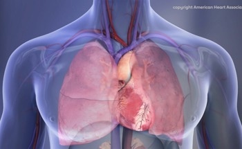 Predicting Sudden Cardiac Death Using Artificial Intelligence